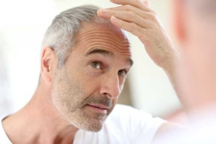 Goede natuurlijke haargroeimiddelen voor mannen