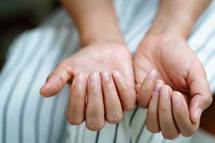Oorzaak broze en gescheurde nagels.