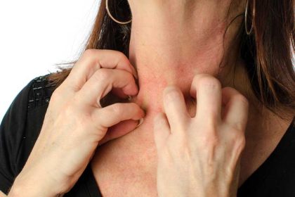 Vitamine C bij allergie, jeuk en hooikoorts